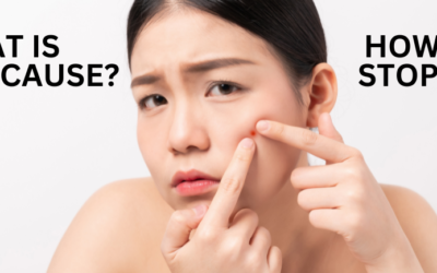 How to Reduce Pimples on Your Face?